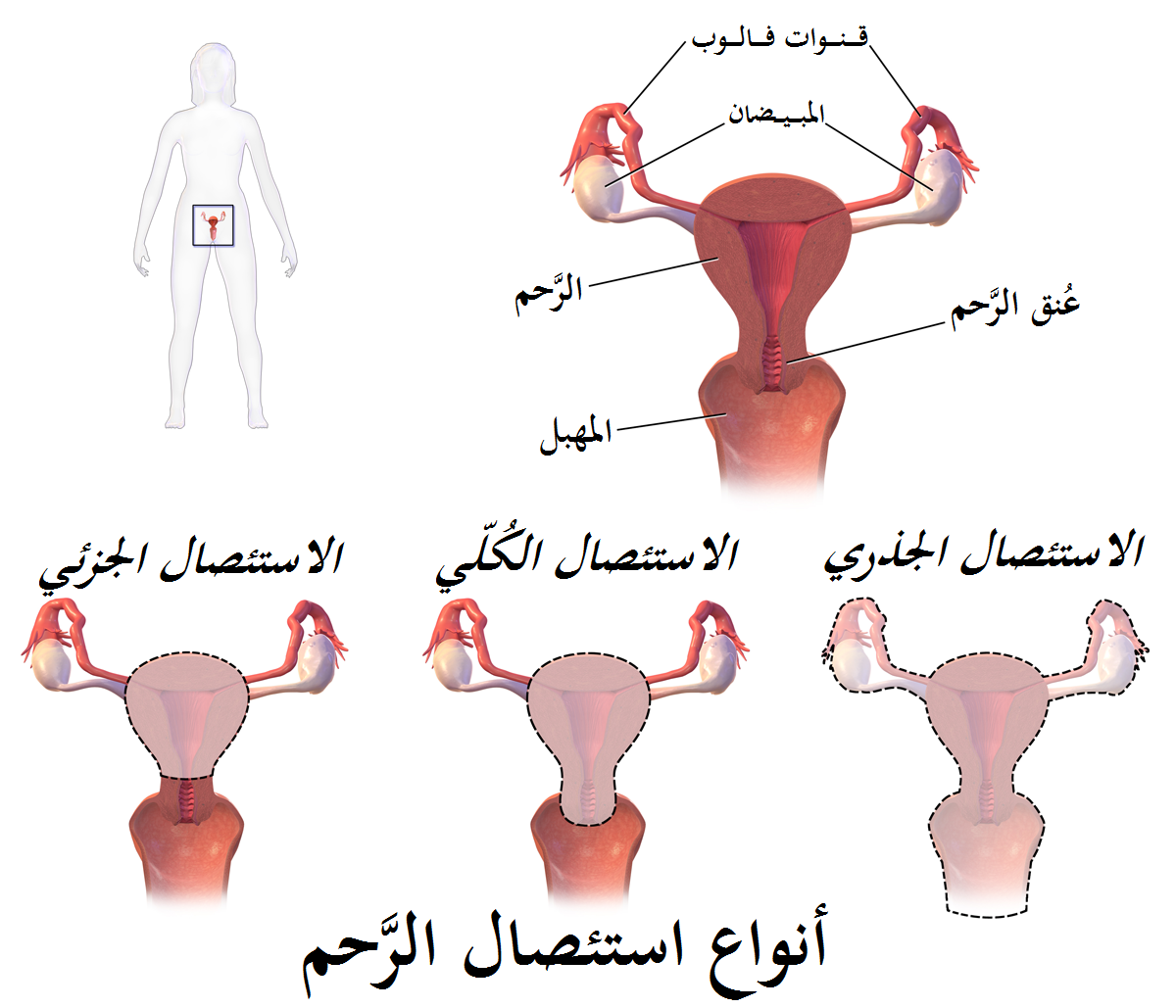تنظيف الرحم بالطرق الطبيعية