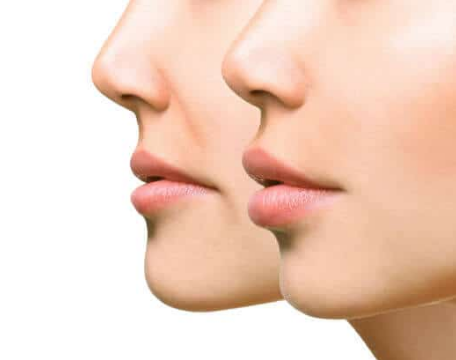 خلطات لتسمين الوجه في وقت قياسي